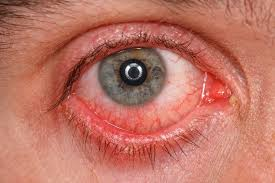 Cornea Services